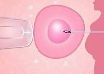 青岛地区有哪些私立的机构可以做试管技术？日本试管婴儿成功率高达八成!