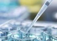 曲靖市妇幼保健院洗精费用多少钱？试管婴儿移植成功后检查流程有哪些？